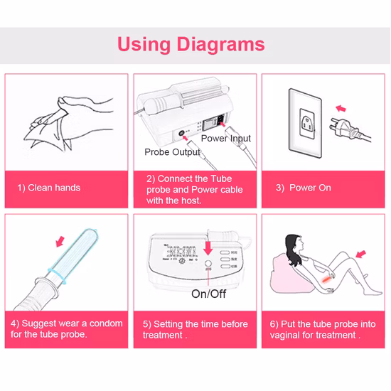 家庭用婦人科治療用機器