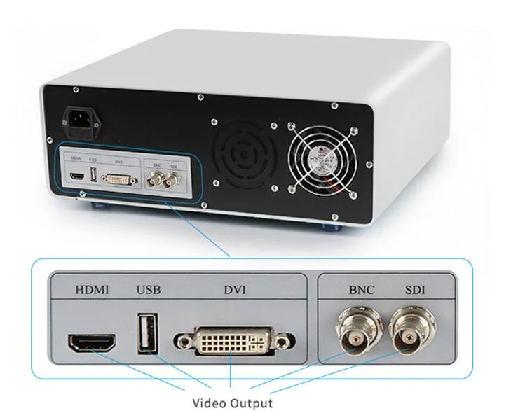 Medical Endoscopic Equipment for Cystoscope